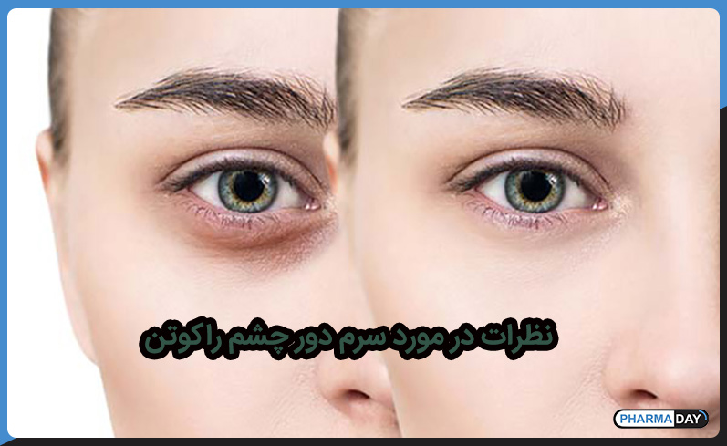 نظرات سرم دور چشم راکوتن